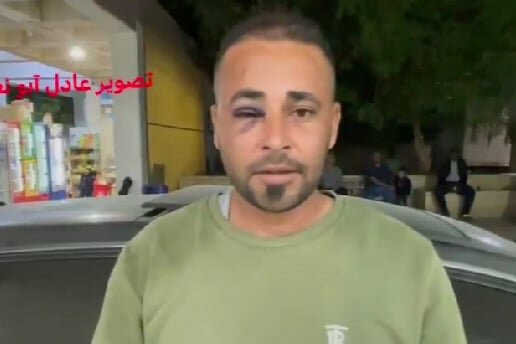 Izraelska vojska pod istragom zbog napada na medicinskog radnika u Palestini: Šta kaže Times of Israel?