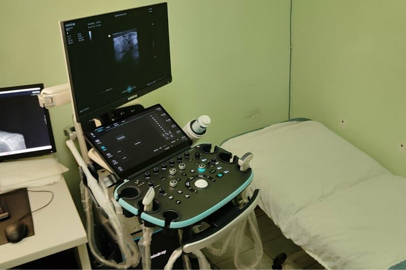 Digitalizacija radiološke službe: Kantonalna bolnica Goražde nabavila novi ultrazvučni aparat